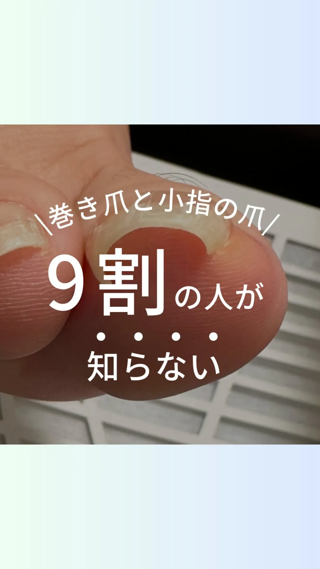 巻き爪と小指の意外な関係性