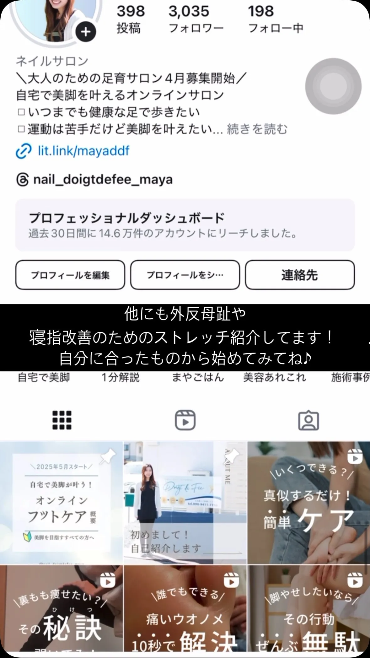 親指動きません🙅‍♀️