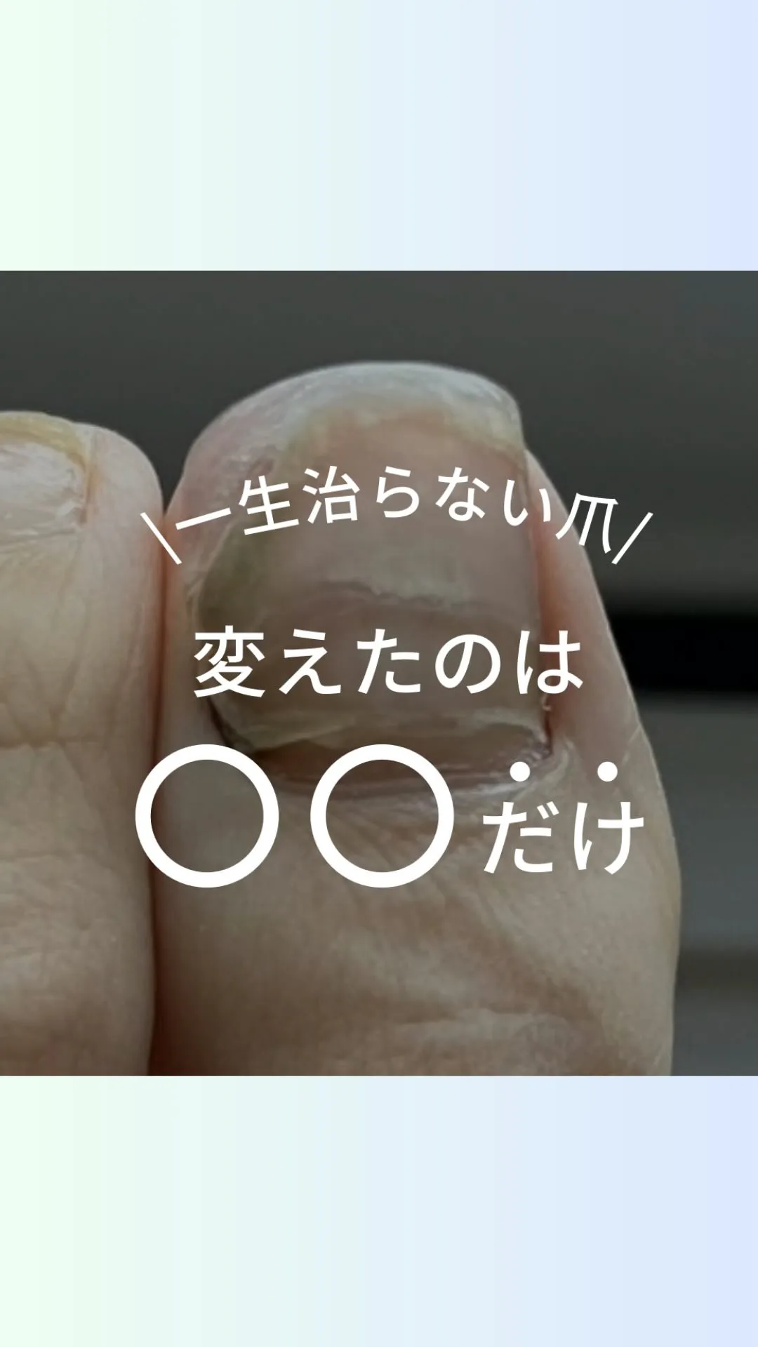 変えたのは「足指の使い方」