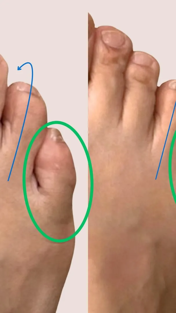 寝指セミナー先着200名埋まるまでアーカイブ残します！